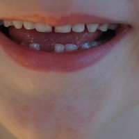 Zdravý úsměv aneb zásady dentální hygieny
